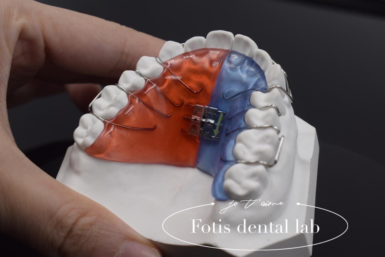 مصنع تيجان تجميلية